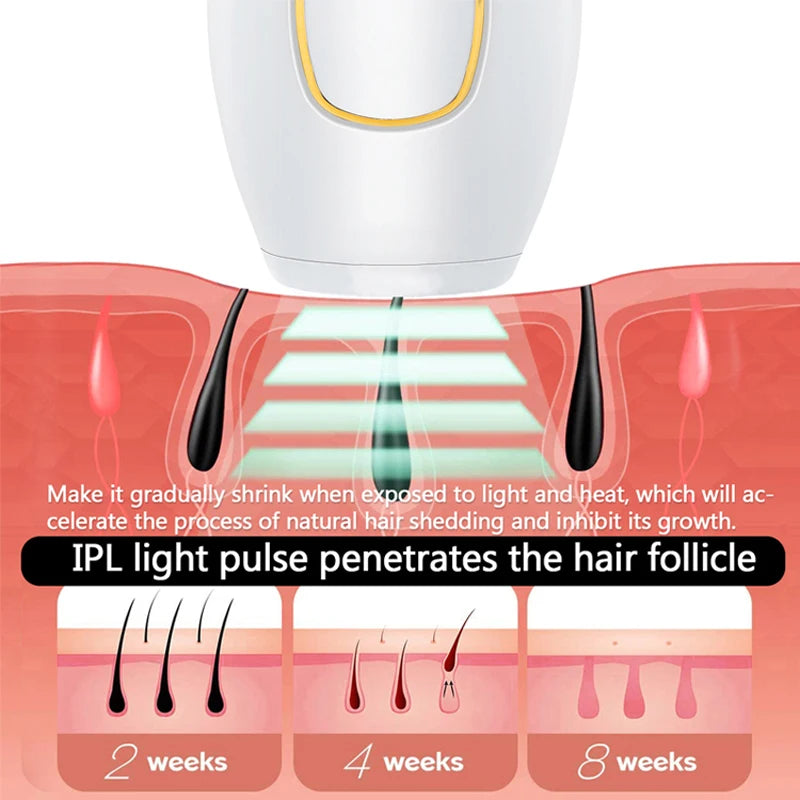 SilkPulse Pro – IPL Laser Hair Remover